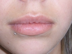 Lèvre inférieure