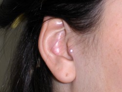 Tragus